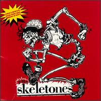 Skeletones von Skeletones